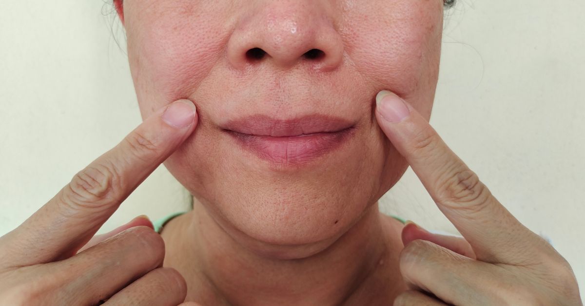 What is the Best Cream for Deep Wrinkles Around the Mouth?