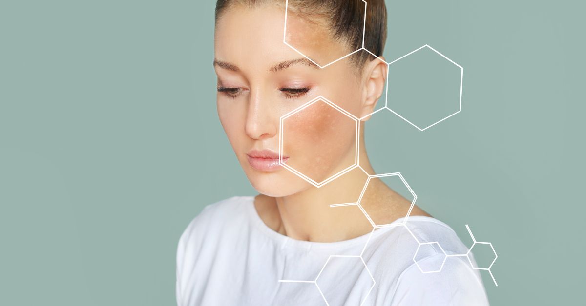 How to Know Your Skin Type: The Only Guide You’ll Need