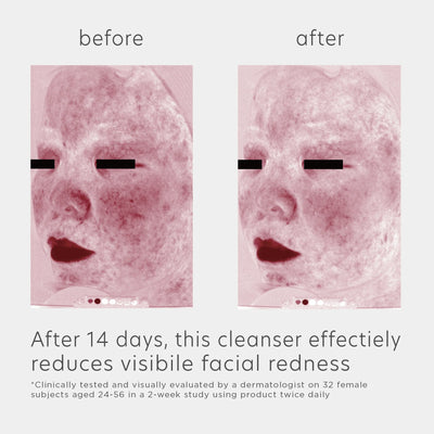 EltaMD Skin Recovery Amino Acid Foaming Cleanser