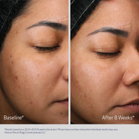 Obagi Retinol + PHA