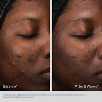 Obagi Retinol + PHA
