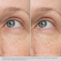 Obagi Hydro-Drops  Rejuvenating Eye Gel Cream