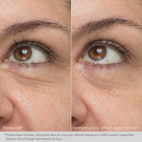 Obagi Hydro-Drops  Rejuvenating Eye Gel Cream