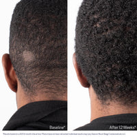 Obagi Nu-Cil Biostim Scalp Serum