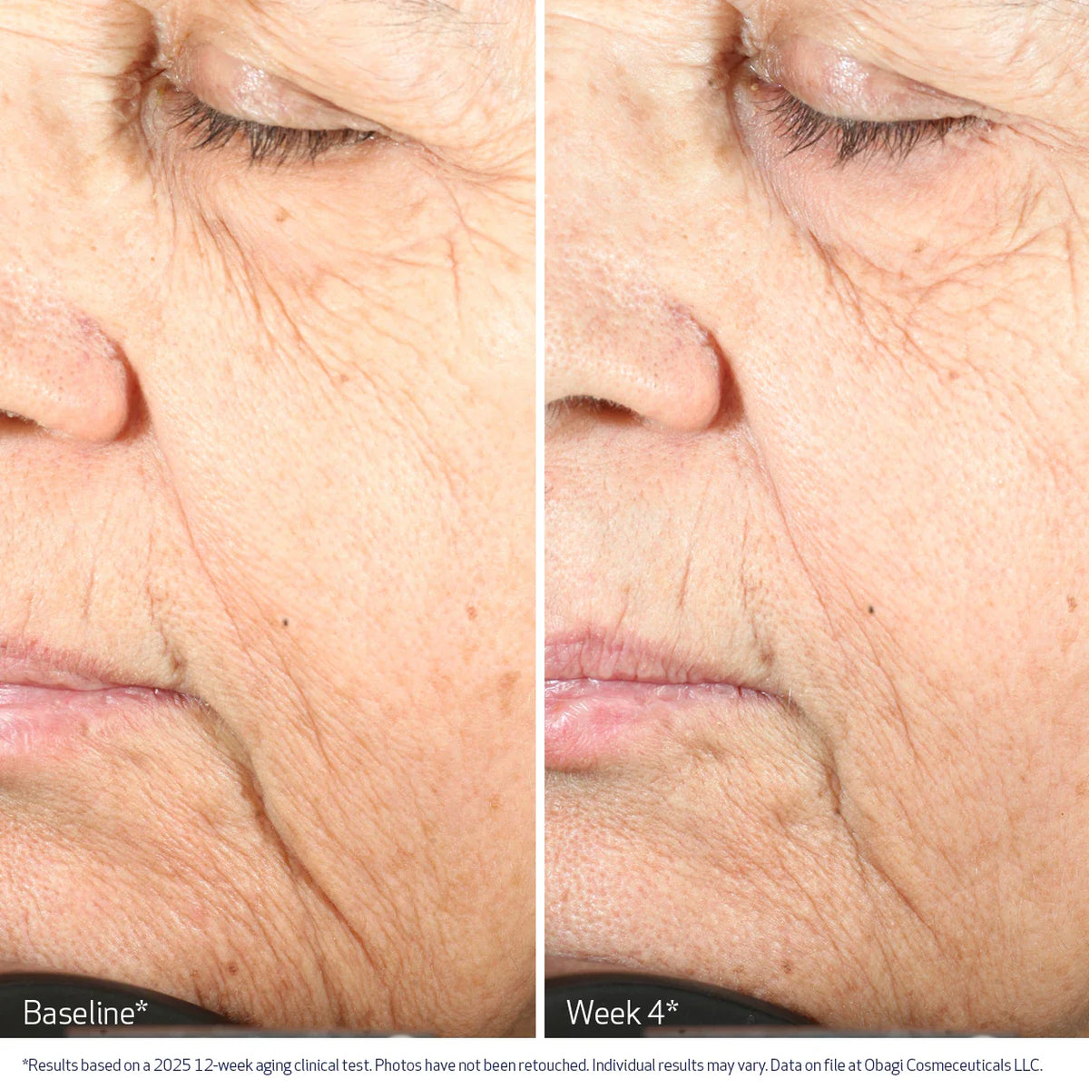 Obagi Cellular Renewal Serum