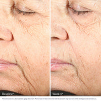 Obagi Cellular Renewal Serum