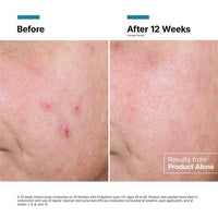 Skinceuticals Advanced RGN-6