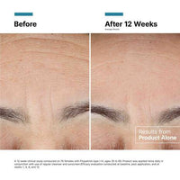 Skinceuticals Advanced RGN-6
