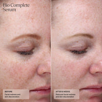 Sente Bio Complete Serum