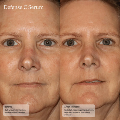 Sente Defense C Serum