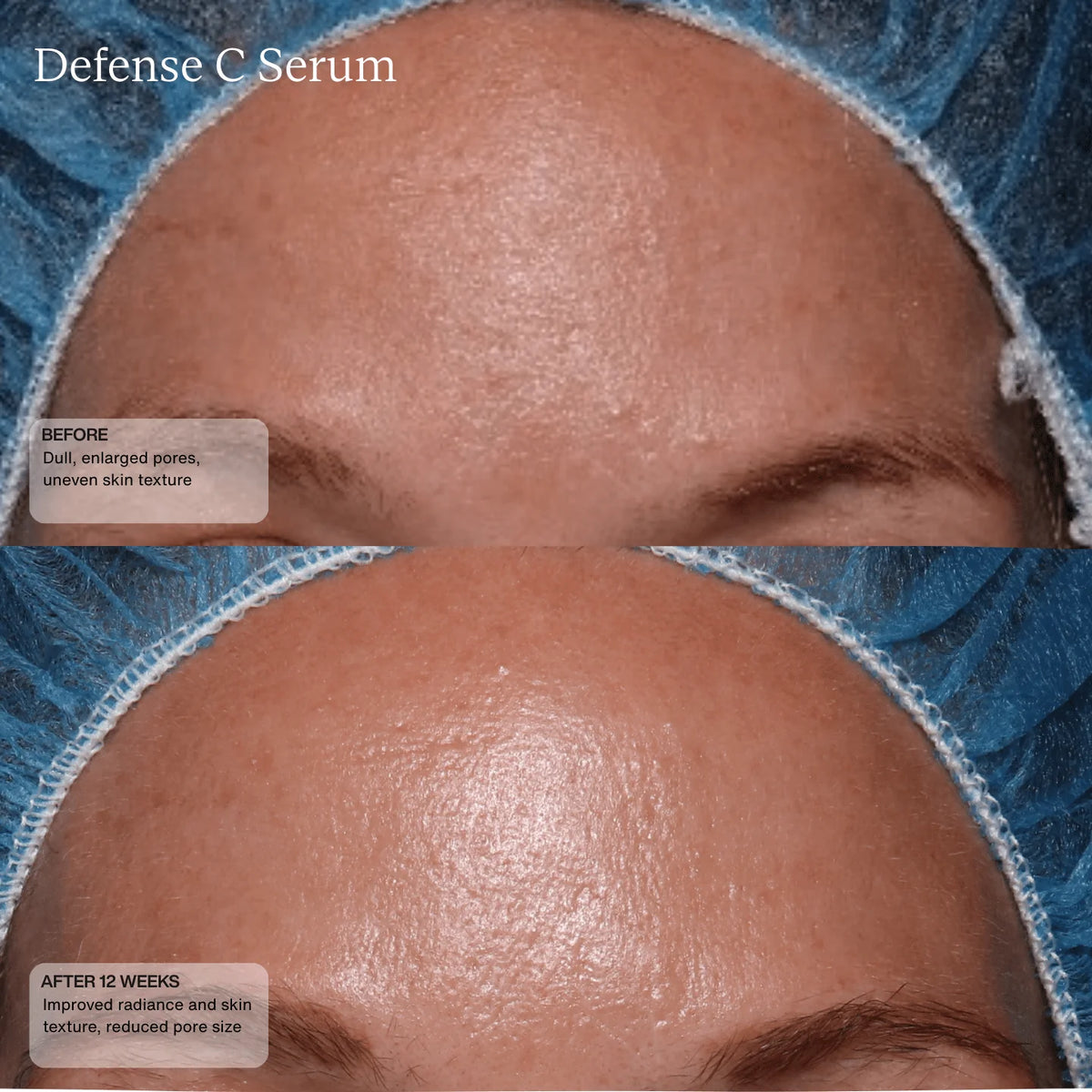 Sente Defense C Serum