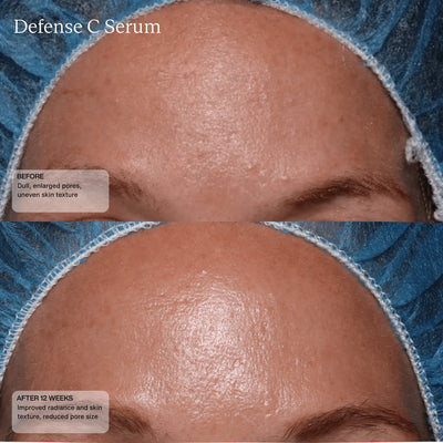 Sente Defense C Serum