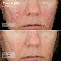 Sente Dermal Repair Cream