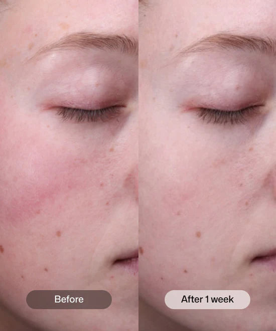 Revision Radiance + Resurfacing Serum