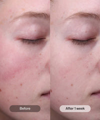 Revision Radiance + Resurfacing Serum