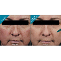 SkinCeuticals Phloretin CF - Totality Skincare