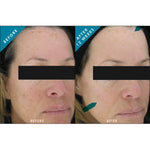 SkinCeuticals Phloretin CF Gel - Totality Skincare
