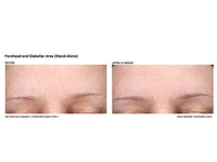 Revision Skincare Revox Line Relaxer - Totality Skincare