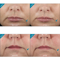 SkinCeuticals Metacell Renewal B3 - Totality Skincare