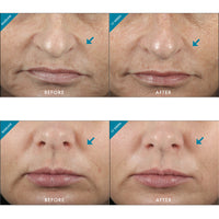 SkinCeuticals Metacell Renewal B3 - Totality Skincare