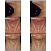 SkinCeuticals Tripeptide-R Neck Repair - Totality Skincare