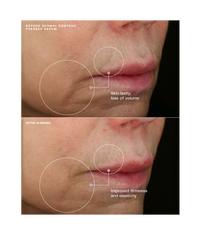 Sente Dermal Contour Pressed Serum - Totality Medispa and Skincare