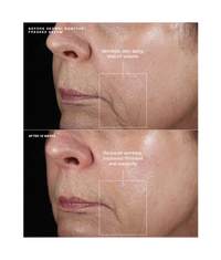 Sente Dermal Contour Pressed Serum - Totality Medispa and Skincare