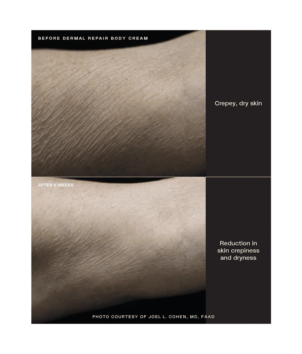 Sente Dermal Repair Body Cream - Totality Medispa and Skincare