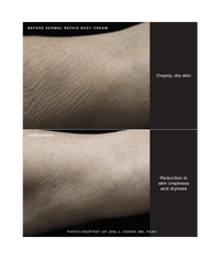 Sente Dermal Repair Body Cream - Totality Medispa and Skincare