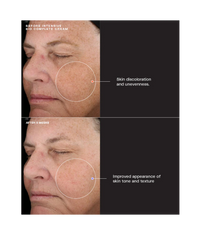 Sente Intensive Bio Complete Cream - Totality Medispa and Skincare