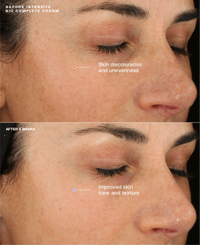 Sente Intensive Bio Complete Cream - Totality Medispa and Skincare