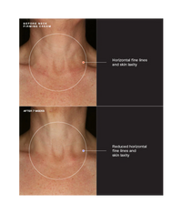 Sente Neck Firming Cream - Totality Medispa and Skincare