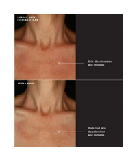 Sente Neck Firming Cream - Totality Medispa and Skincare