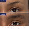 Obagi Nu-Cil™ Eyebrow Boosting Serum - Totality Medispa and Skincare