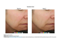 Sente Dermal Repair Ultra-Nourish 1.7 oz - Totality Skincare
