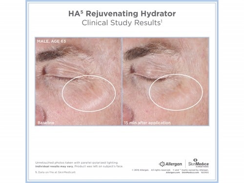 SkinMedica HA⁵® Rejuvenating Hydrator - Totality Skincare