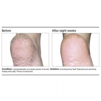 PCA Skin Body Therapy - Totality Skincare