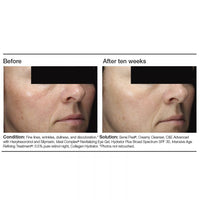 PCA Skin C&E Advanced - Totality Skincare
