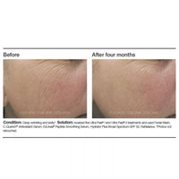 PCA Skin C-Quench® Antioxidant Serum - Totality Skincare
