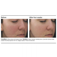 PCA Skin Dual Action Redness Relief - Totality Skincare