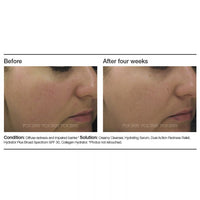PCA Skin Dual Action Redness Relief - Totality Skincare