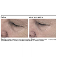 PCA Skin ExLinea® Peptide Smoothing Serum - Totality Skincare