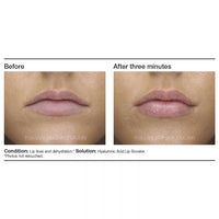 PCA Skin Hyaluronic Acid Lip Booster - Totality Skincare