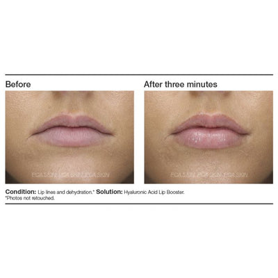 PCA Skin Hyaluronic Acid Lip Booster - Totality Skincare