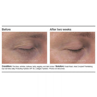 PCA Skin Ideal Complex® Revitalizing Eye Gel - Totality Skincare