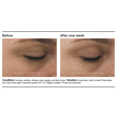 PCA Skin Ideal Complex® Restorative Eye Cream - Totality Skincare