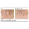 PCA Skin Pigment Bar® - Totality Skincare