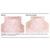 PCA Skin Perfecting Neck & Decollete - Totality Skincare