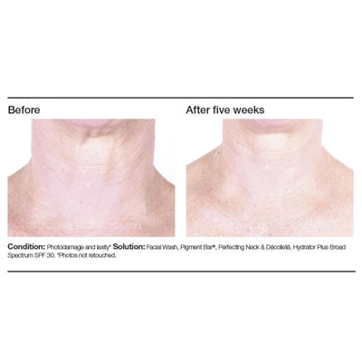 PCA Skin Perfecting Neck & Decollete - Totality Skincare