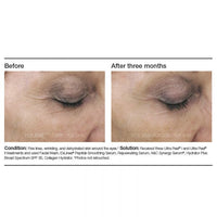 PCA Skin Rejuvenating Serum - Totality Skincare